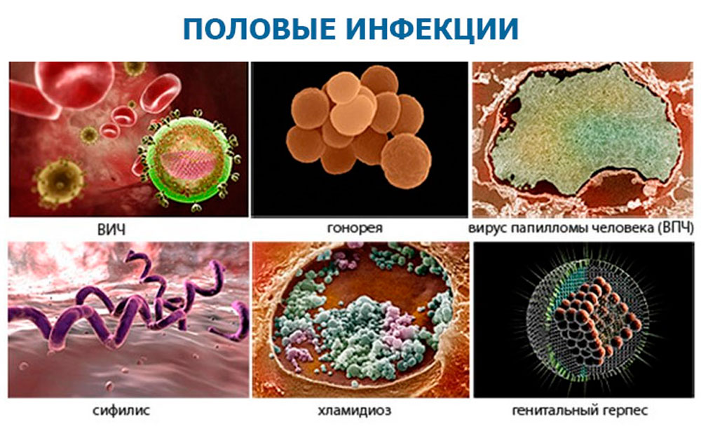 скрытые инфекции у женщин список